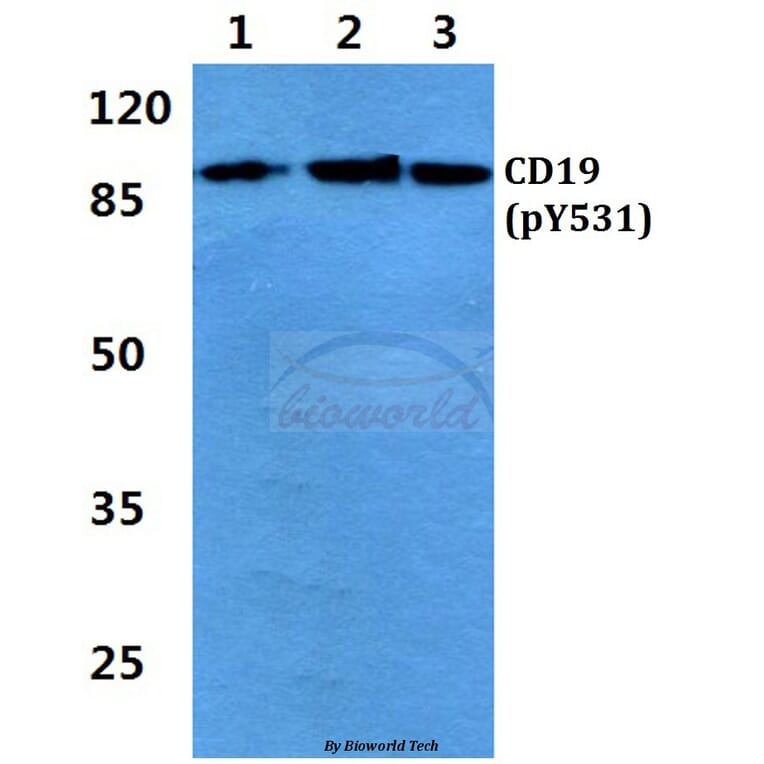 Anti-CD19 (phospho-Y531) Antibody from Bioworld Technology (BS4664) - Antibodies.com