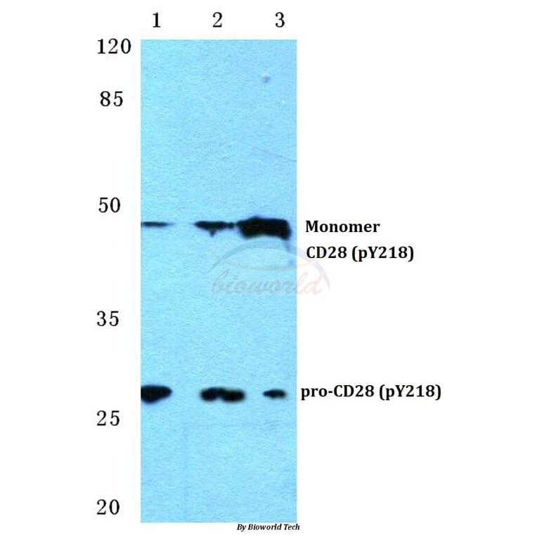 Anti-CD28 (phospho-Y218) Antibody from Bioworld Technology (BS4665) - Antibodies.com