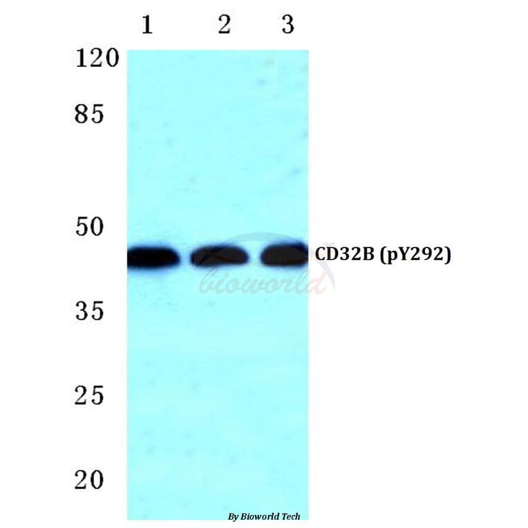 Anti-CD32-B (phospho-Y292) Antibody from Bioworld Technology (BS4667) - Antibodies.com