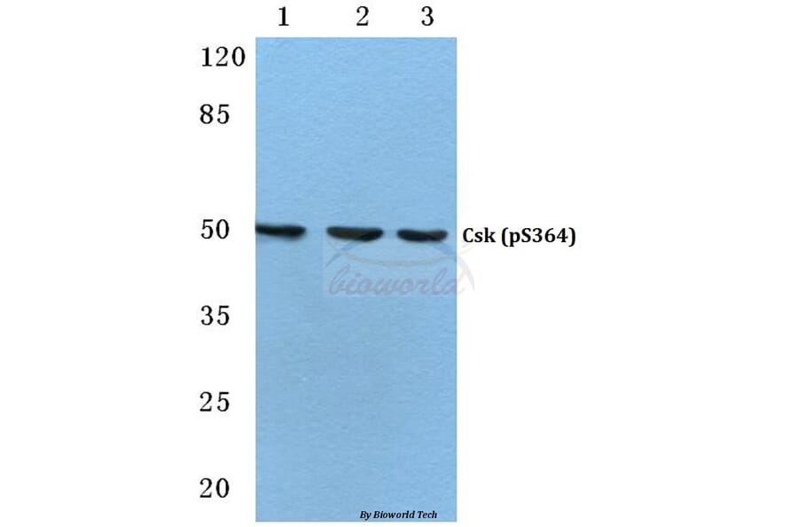 Anti-Csk (phospho-S364) Antibody from Bioworld Technology (BS4673) - Antibodies.com