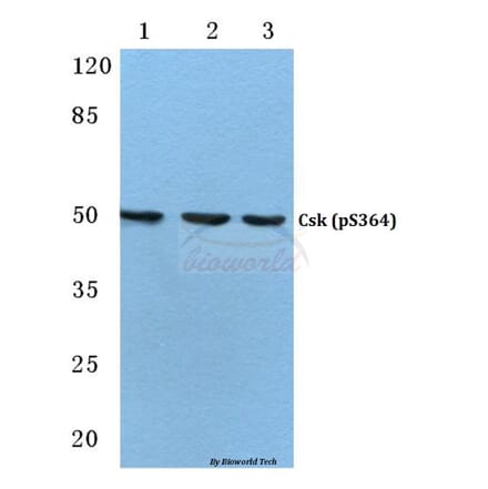 Anti-Csk (phospho-S364) Antibody from Bioworld Technology (BS4673) - Antibodies.com