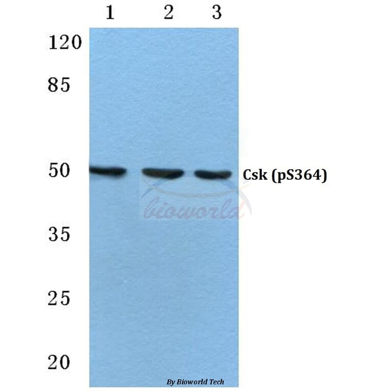 Anti-Csk (phospho-S364) Antibody from Bioworld Technology (BS4673) - Antibodies.com
