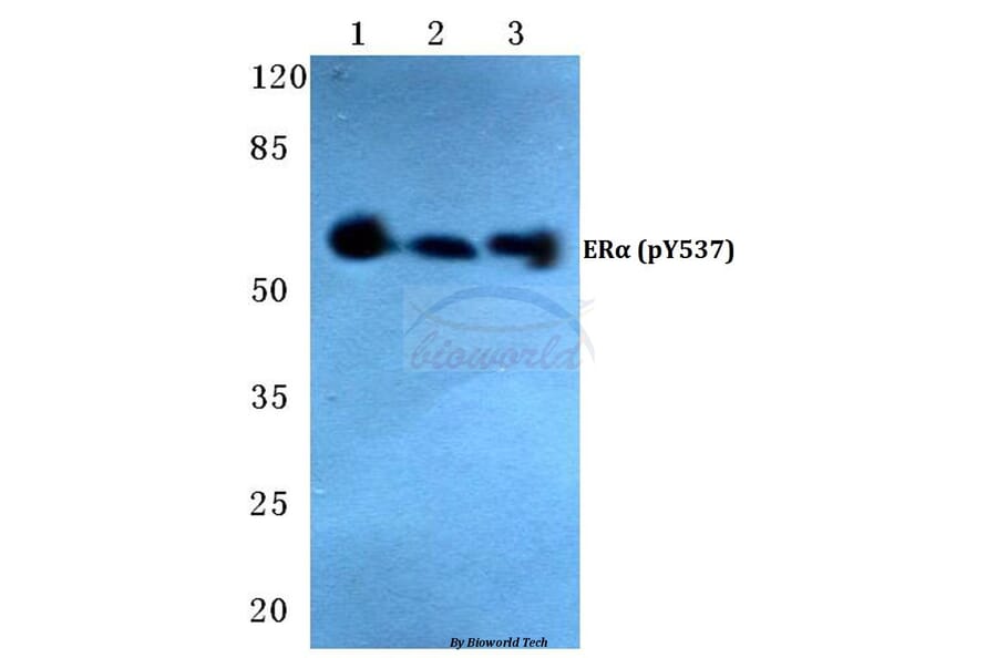 Anti-ERα (phospho-Y537) Antibody from Bioworld Technology (BS4683) - Antibodies.com