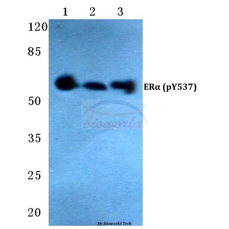 Anti-ERα (phospho-Y537) Antibody from Bioworld Technology (BS4683) - Antibodies.com