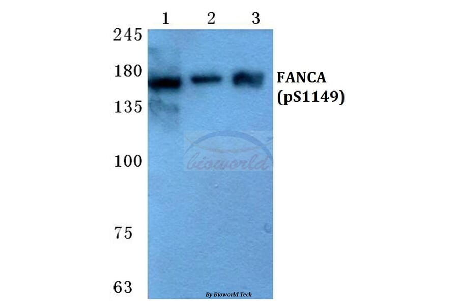 Anti-FANCA (phospho-S1149) Antibody from Bioworld Technology (BS4685) - Antibodies.com