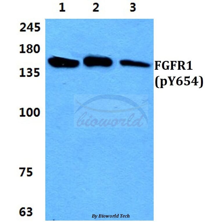 Anti-FGFR1 (phospho-Y654) Antibody from Bioworld Technology (BS4686) - Antibodies.com