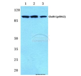 Anti-GluR4 (phospho-S862) Antibody from Bioworld Technology (BS4690) - Antibodies.com