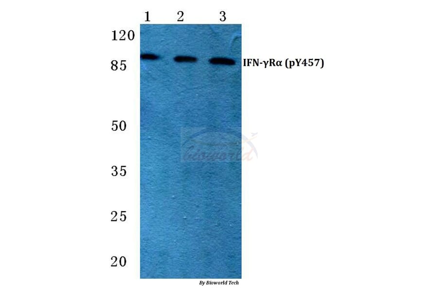Anti-IFN-γRα (phospho-Y457) Antibody from Bioworld Technology (BS4697) - Antibodies.com