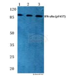 Anti-IFN-γRα (phospho-Y457) Antibody from Bioworld Technology (BS4697) - Antibodies.com
