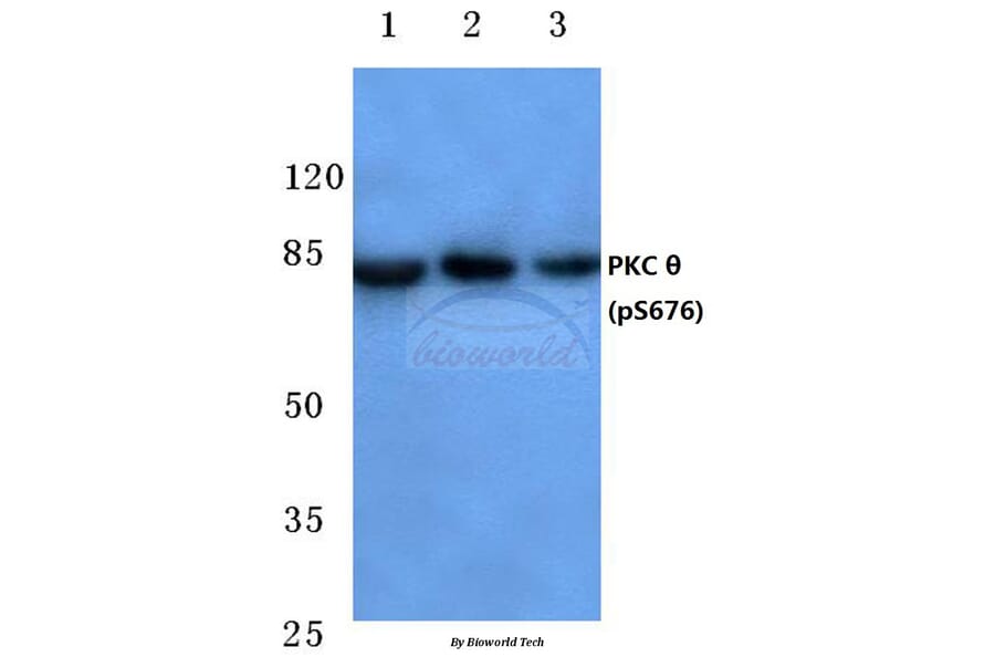 Anti-PKC θ (phospho-S676) Antibody from Bioworld Technology (BS4708) - Antibodies.com