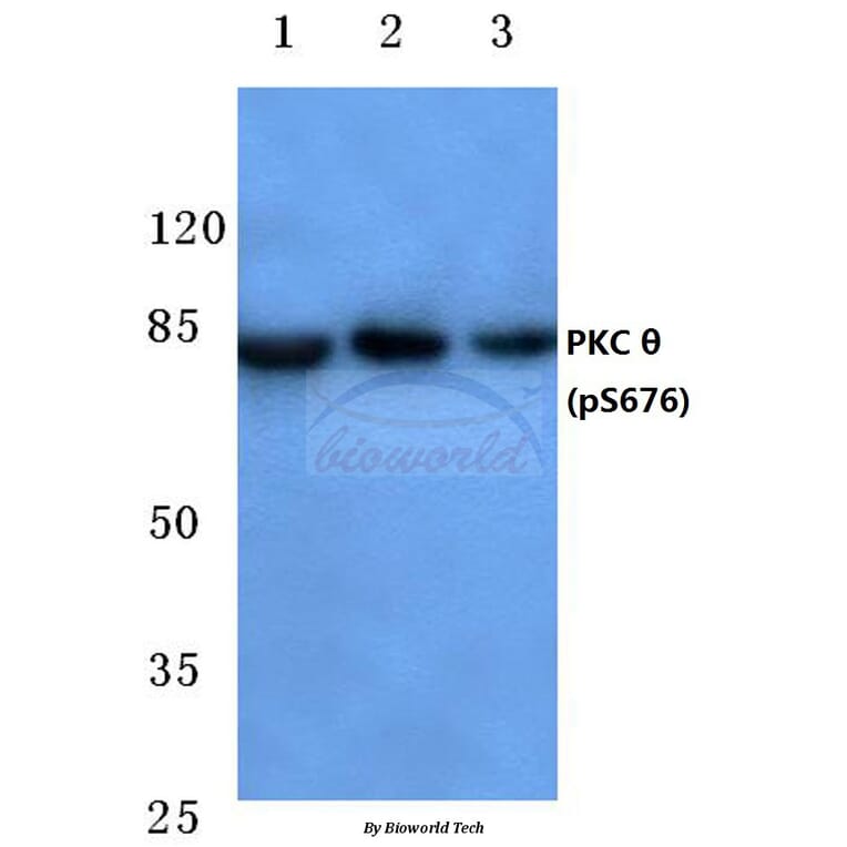 Anti-PKC θ (phospho-S676) Antibody from Bioworld Technology (BS4708) - Antibodies.com