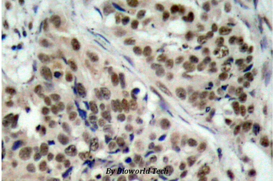 Anti-FKHR/FoxO1 (phospho-S256) Antibody from Bioworld Technology (BS4711) - Antibodies.com