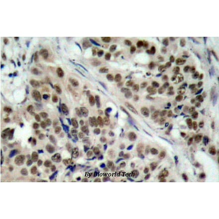 Anti-FKHR/FoxO1 (phospho-S256) Antibody from Bioworld Technology (BS4711) - Antibodies.com