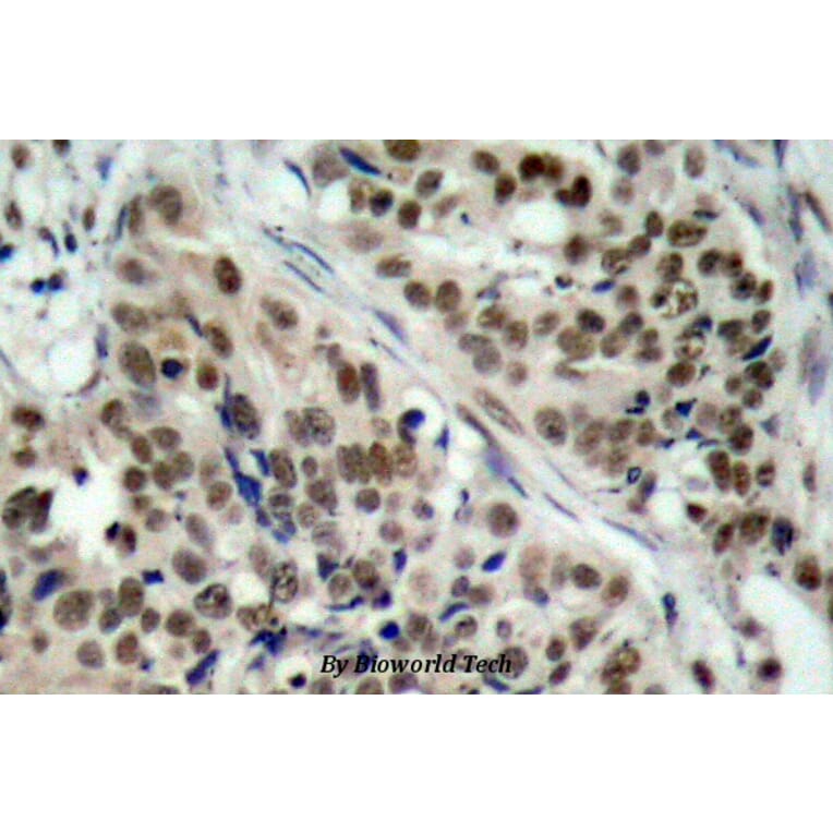 Anti-FKHR/FoxO1 (phospho-S256) Antibody from Bioworld Technology (BS4711) - Antibodies.com