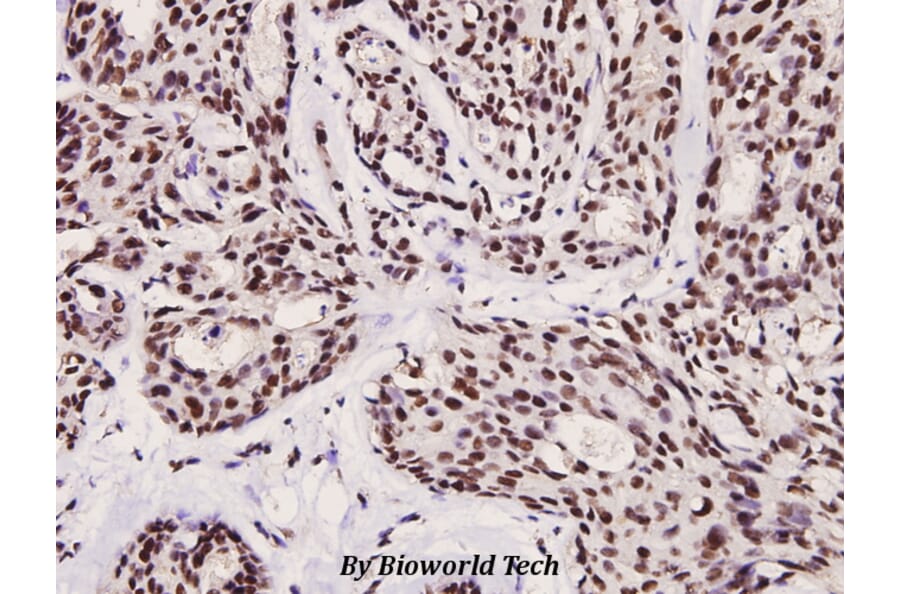 Anti-FoxO3A (phospho-S253) Antibody from Bioworld Technology (BS4713) - Antibodies.com