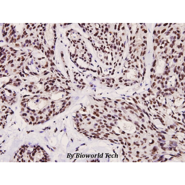 Anti-FoxO3A (phospho-S253) Antibody from Bioworld Technology (BS4713) - Antibodies.com