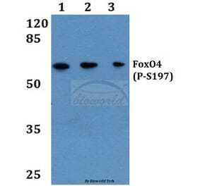 Anti-FoxO4 (phospho-S197) Antibody from Bioworld Technology (BS4714) - Antibodies.com