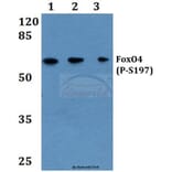 Anti-FoxO4 (phospho-S197) Antibody from Bioworld Technology (BS4714) - Antibodies.com