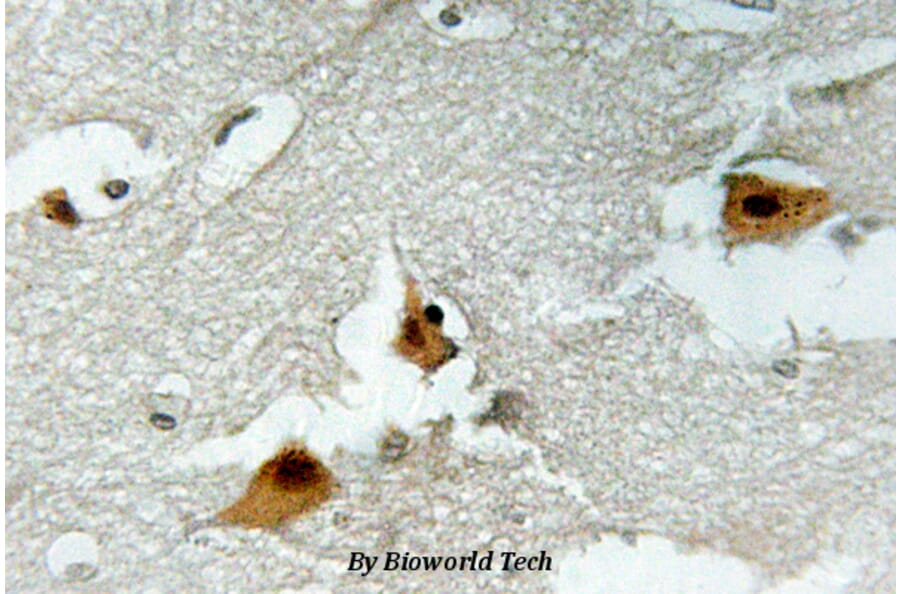 Anti-FoxO4 (phospho-S197) Antibody from Bioworld Technology (BS4714) - Antibodies.com