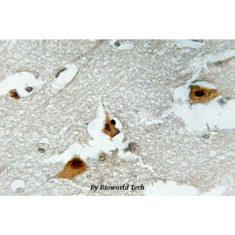 Anti-FoxO4 (phospho-S197) Antibody from Bioworld Technology (BS4714) - Antibodies.com