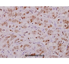 Anti-Cofilin (phospho-S3) Antibody from Bioworld Technology (BS4716) - Antibodies.com