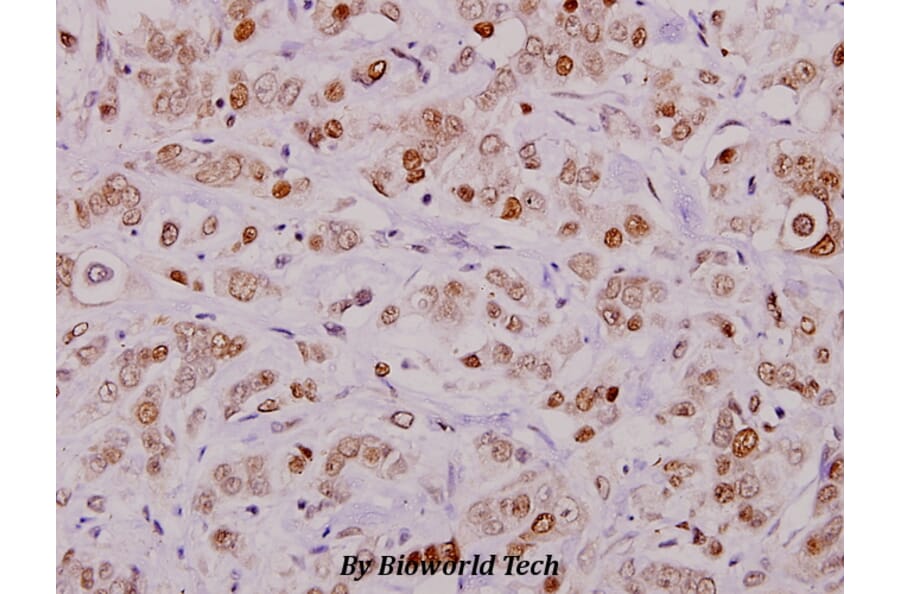 Anti-Cofilin (phospho-S3) Antibody from Bioworld Technology (BS4716) - Antibodies.com