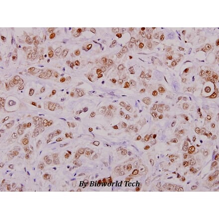 Anti-Cofilin (phospho-S3) Antibody from Bioworld Technology (BS4716) - Antibodies.com
