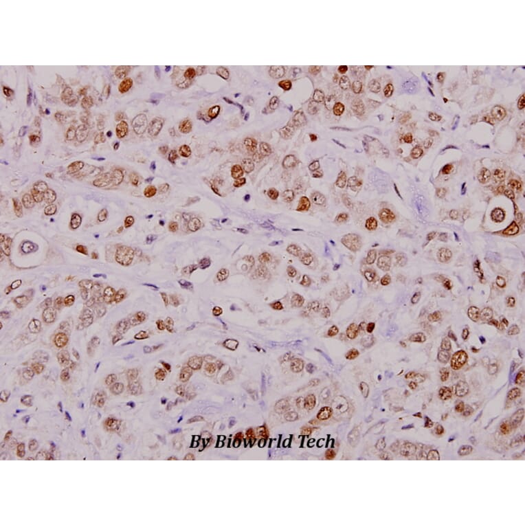 Anti-Cofilin (phospho-S3) Antibody from Bioworld Technology (BS4716) - Antibodies.com