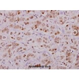Anti-Cofilin (phospho-S3) Antibody from Bioworld Technology (BS4716) - Antibodies.com