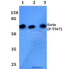 Anti-Ezrin/Radixin/Moesin Antibody from Bioworld Technology (BS4717) - Antibodies.com