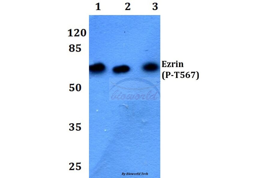 Anti-Ezrin/Radixin/Moesin Antibody from Bioworld Technology (BS4717) - Antibodies.com