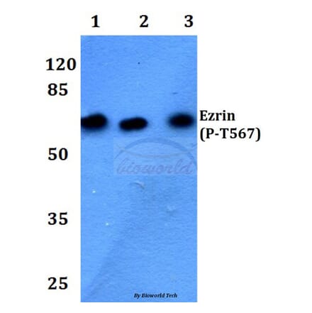Anti-Ezrin/Radixin/Moesin Antibody from Bioworld Technology (BS4717) - Antibodies.com