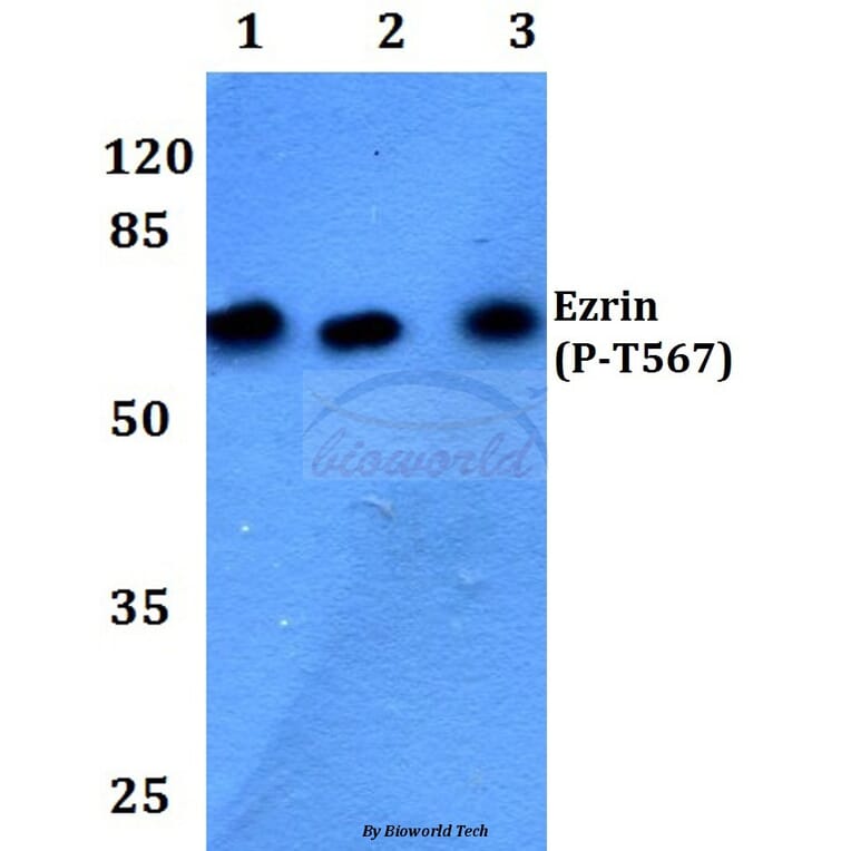 Anti-Ezrin/Radixin/Moesin Antibody from Bioworld Technology (BS4717) - Antibodies.com