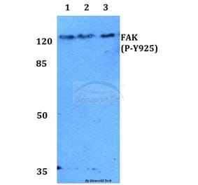 Anti-FAK (phospho-Y925) Antibody from Bioworld Technology (BS4718) - Antibodies.com