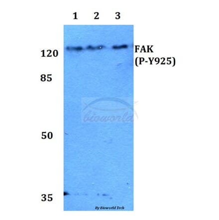 Anti-FAK (phospho-Y925) Antibody from Bioworld Technology (BS4718) - Antibodies.com