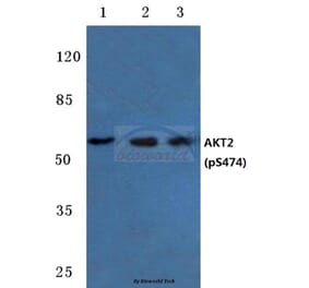 Anti-AKT2 (phospho-S474) Antibody from Bioworld Technology (BS4720) - Antibodies.com
