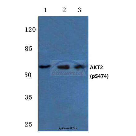 Anti-AKT2 (phospho-S474) Antibody from Bioworld Technology (BS4720) - Antibodies.com