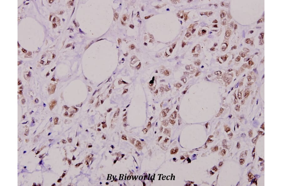Anti-AKT2 (phospho-S474) Antibody from Bioworld Technology (BS4720) - Antibodies.com