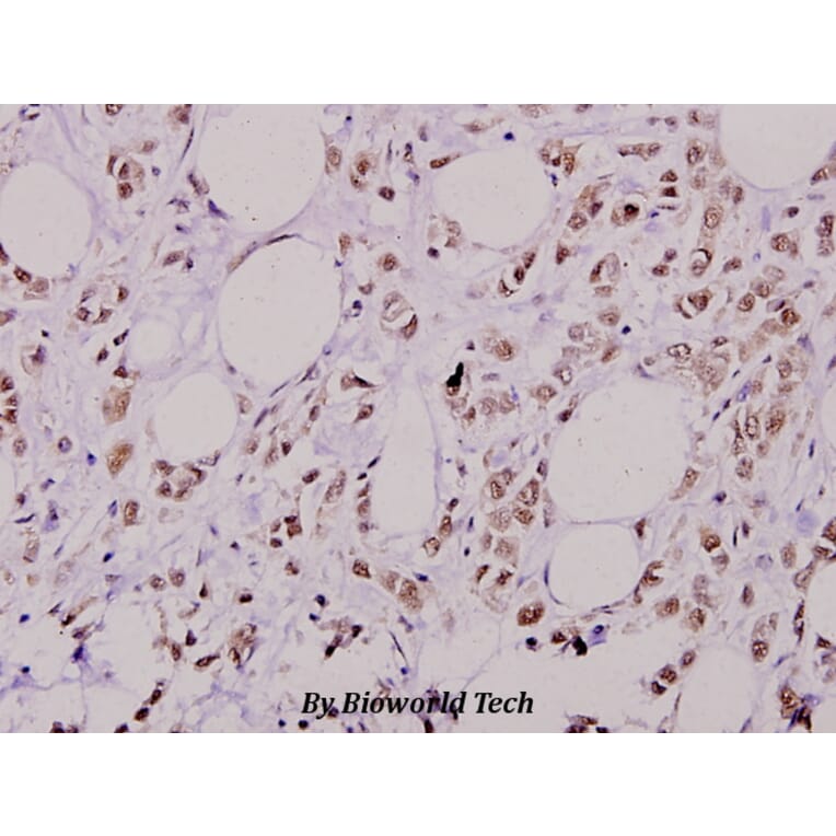 Anti-AKT2 (phospho-S474) Antibody from Bioworld Technology (BS4720) - Antibodies.com