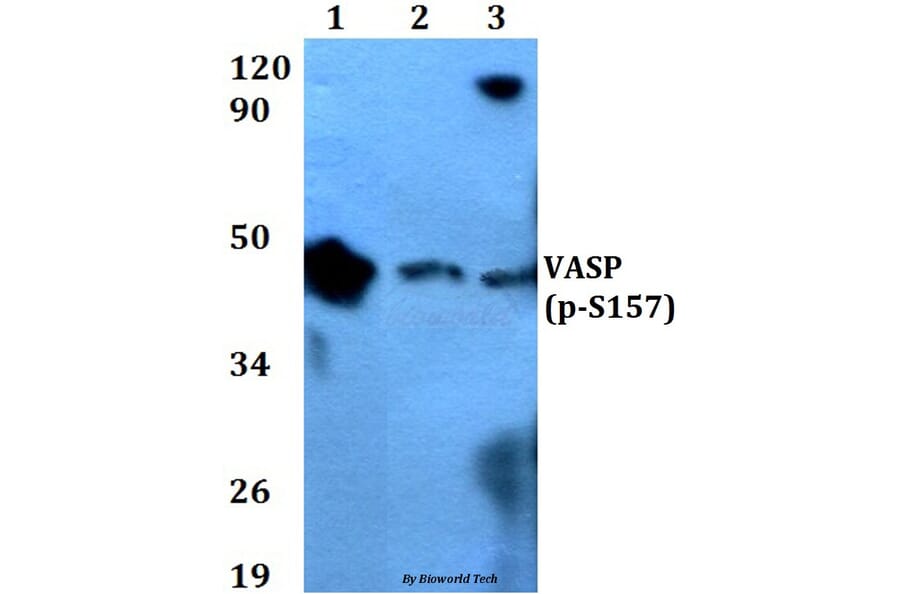 Anti-VASP (phospho-S157) Antibody from Bioworld Technology (BS4722) - Antibodies.com