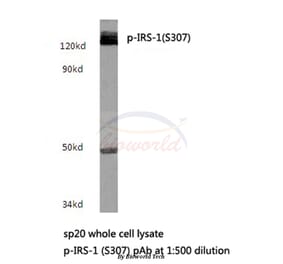 Anti-IRS-1 (phospho-S307) Antibody from Bioworld Technology (BS4725) - Antibodies.com