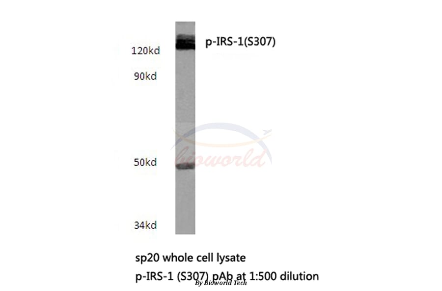 Anti-IRS-1 (phospho-S307) Antibody from Bioworld Technology (BS4725) - Antibodies.com