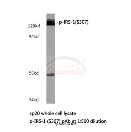 Anti-IRS-1 (phospho-S307) Antibody from Bioworld Technology (BS4725) - Antibodies.com