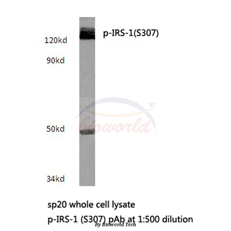 Anti-IRS-1 (phospho-S307) Antibody from Bioworld Technology (BS4725) - Antibodies.com