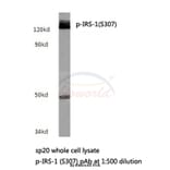 Anti-IRS-1 (phospho-S307) Antibody from Bioworld Technology (BS4725) - Antibodies.com