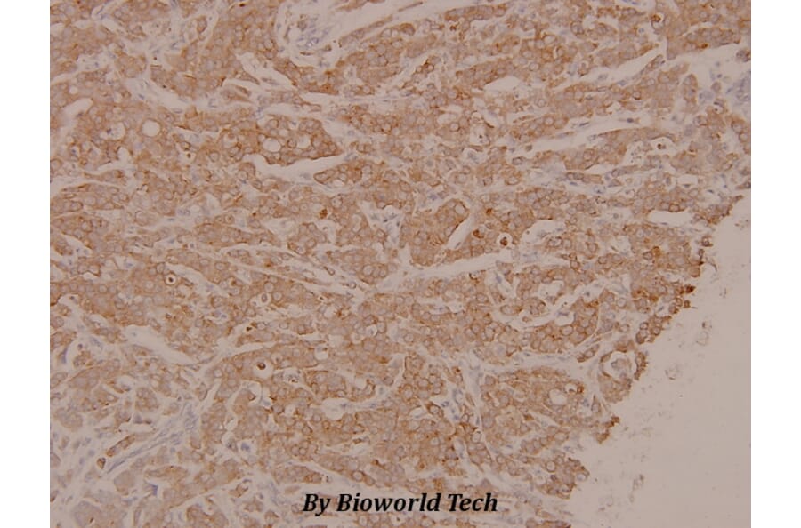 Anti-MEK1/2 (phospho-S222/226) Antibody from Bioworld Technology (BS4734) - Antibodies.com