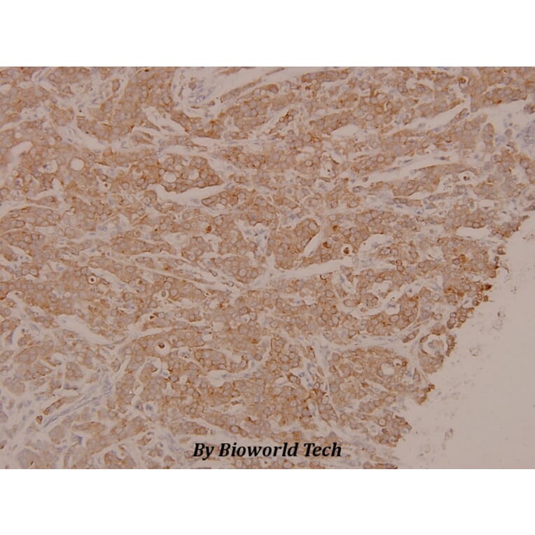 Anti-MEK1/2 (phospho-S222/226) Antibody from Bioworld Technology (BS4734) - Antibodies.com