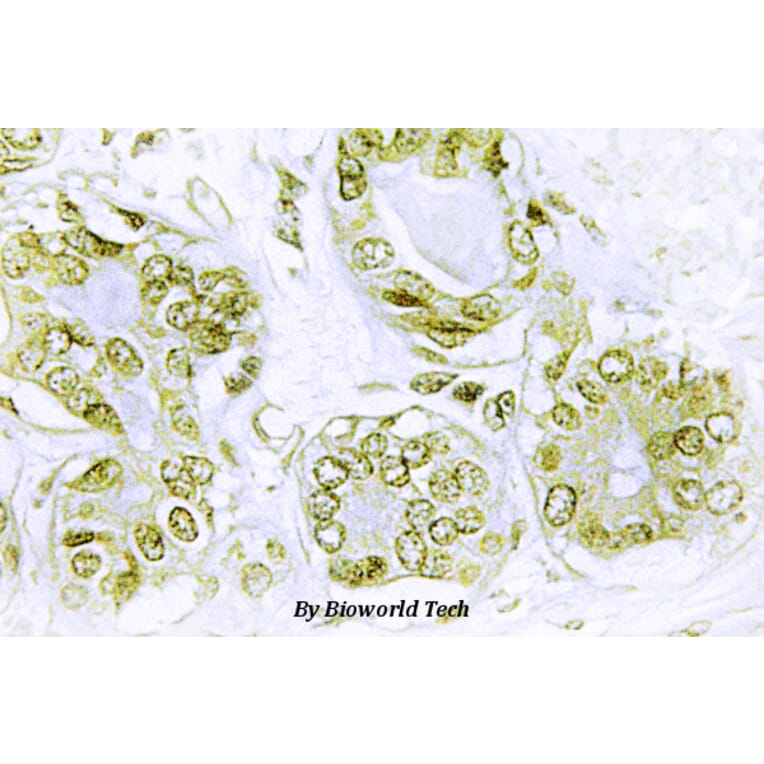 Anti-IkB-α (phospho-Y42) Antibody from Bioworld Technology (BS4736) - Antibodies.com