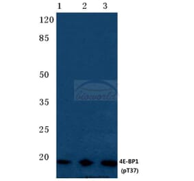 Anti-4E-BP1 (phospho-T37) Antibody from Bioworld Technology (BS4746) - Antibodies.com