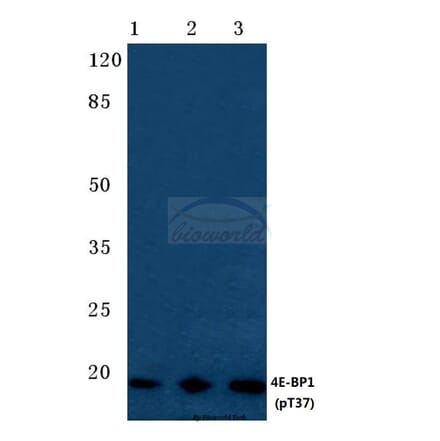 Anti-4E-BP1 (phospho-T37) Antibody from Bioworld Technology (BS4746) - Antibodies.com